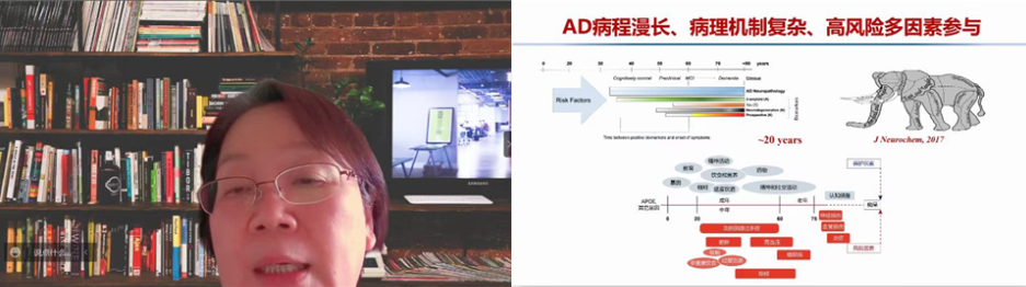 阿尔茨海默病药物治疗新进展交流会 在乌鲁木齐顺利召开